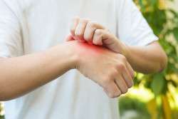 Japan Drugstore Guide: Insect Repellent in Japan
